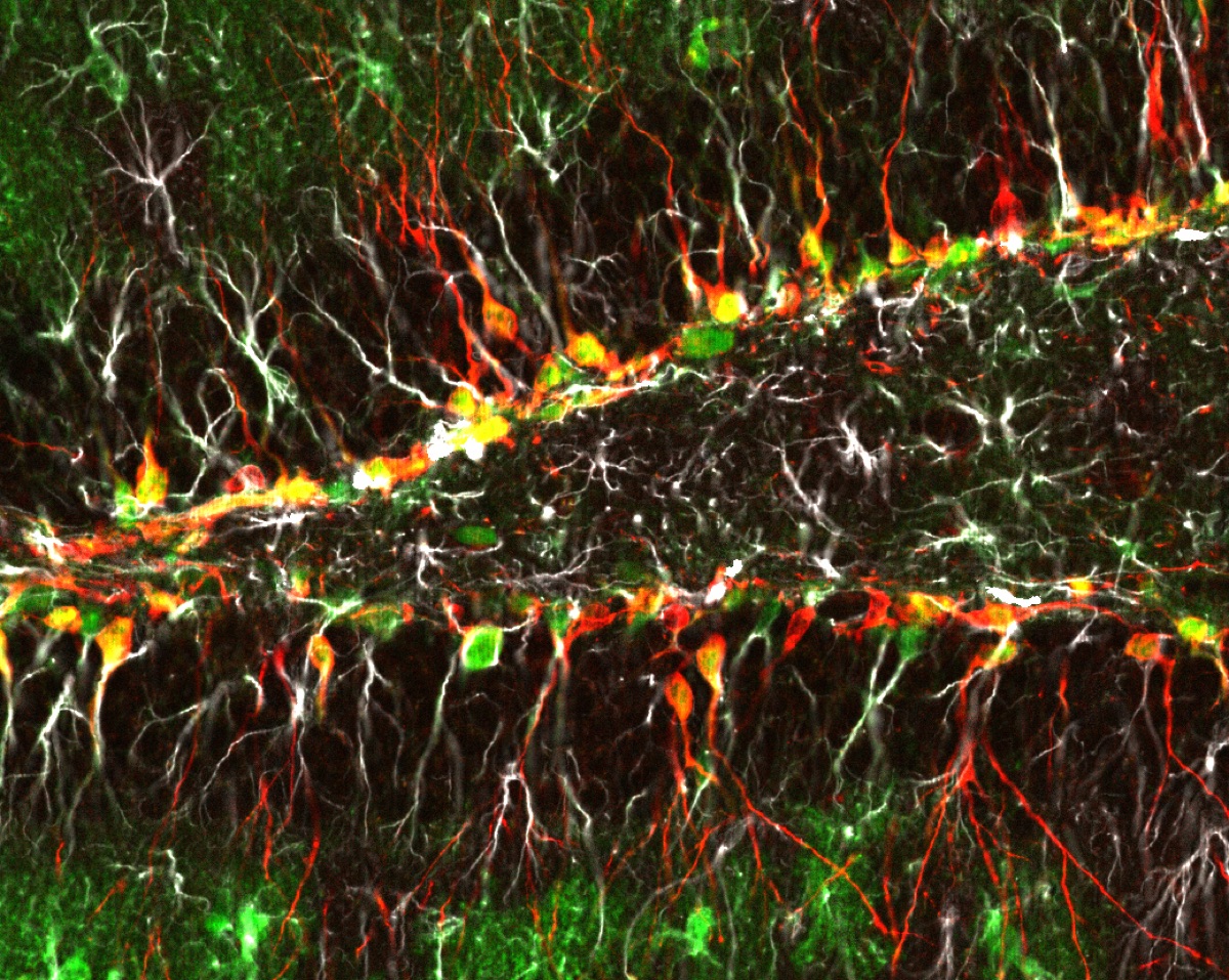 Immunofluorescence microscopy of brain neurogenesis - newborn neuron progeny in green and doublecortin, a marker of immature neurons, in red - a representative illustration of the young, newborn-style neurons found in the aged human hippocampus